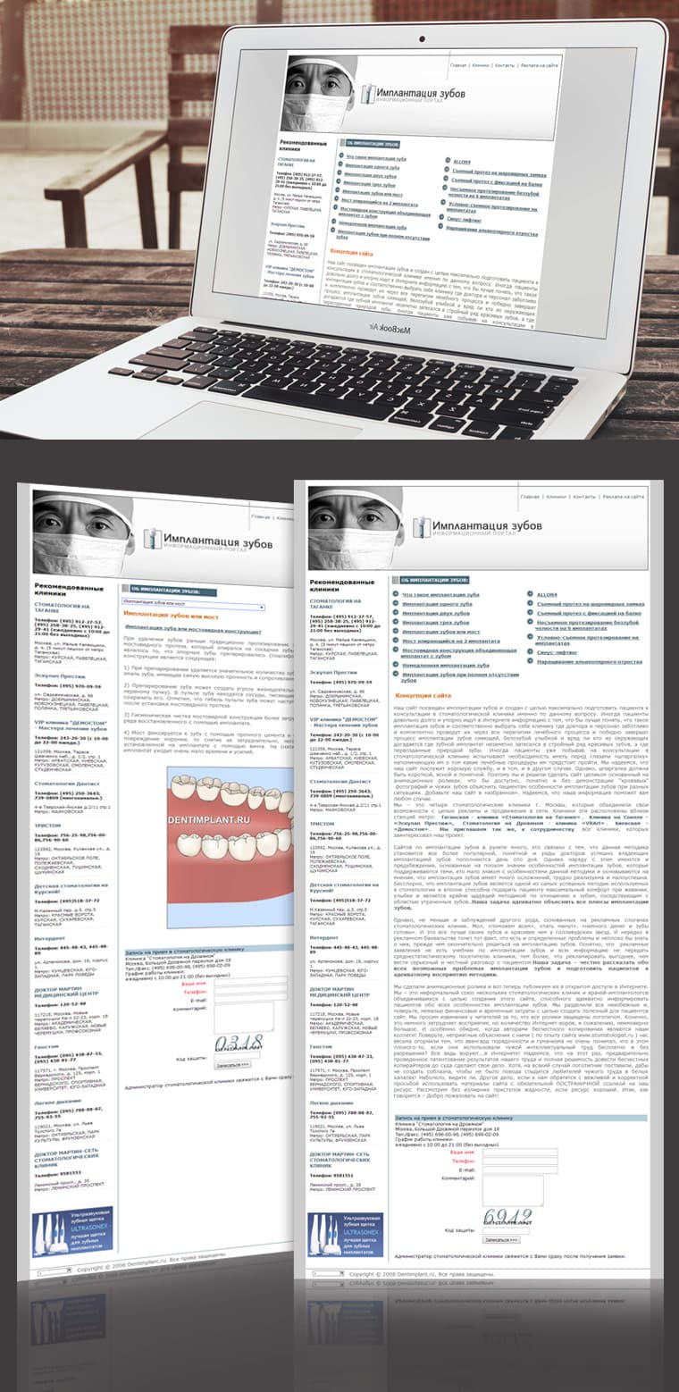 “TEETH IMPLANTATION” INFORMATION PORTAL - Website Design and Development