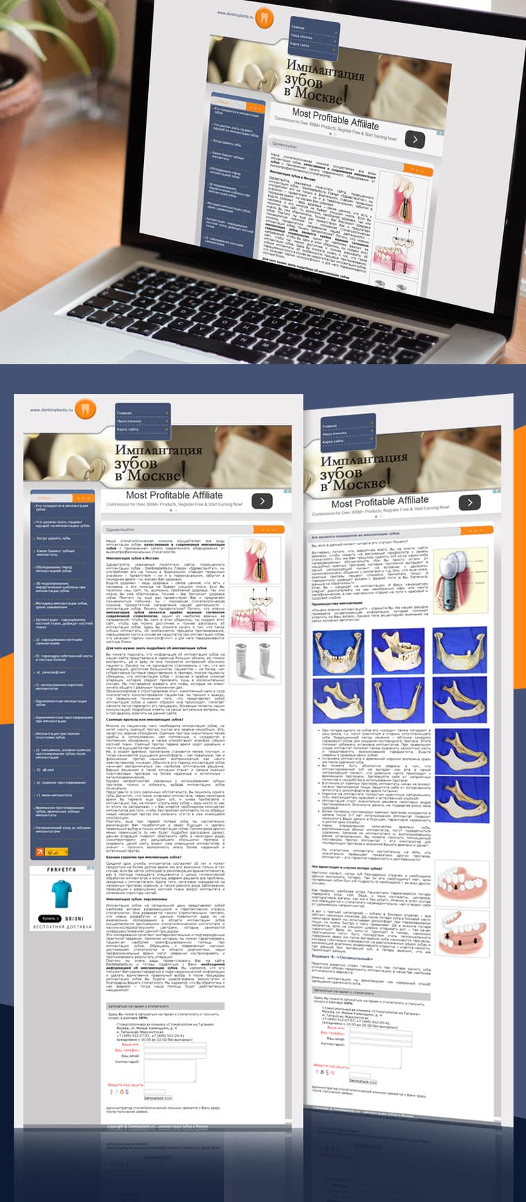 TEETH IMPLANTATION IN MOSCOW - Website Design and Development