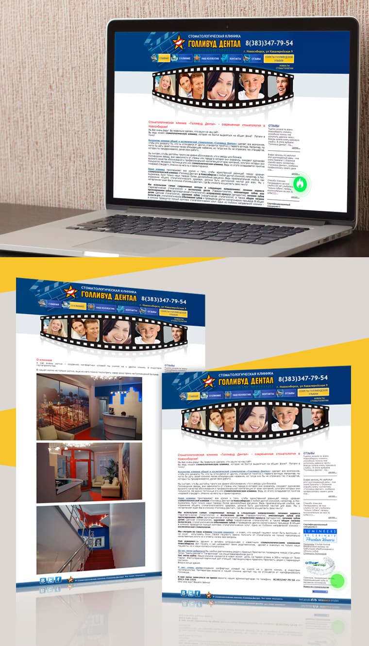 “HOLLYWOOD DENTAL” DENTAL CLINIC - Website Design and Development